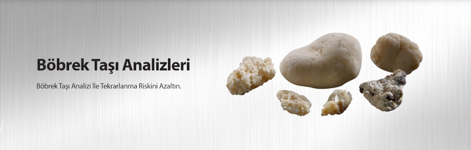 Böbrek Taşı Analizleri